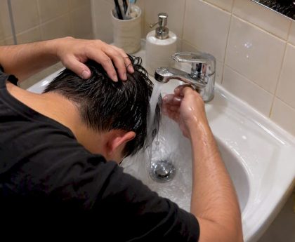 Person rinsing irritated scalp at bathroom sink