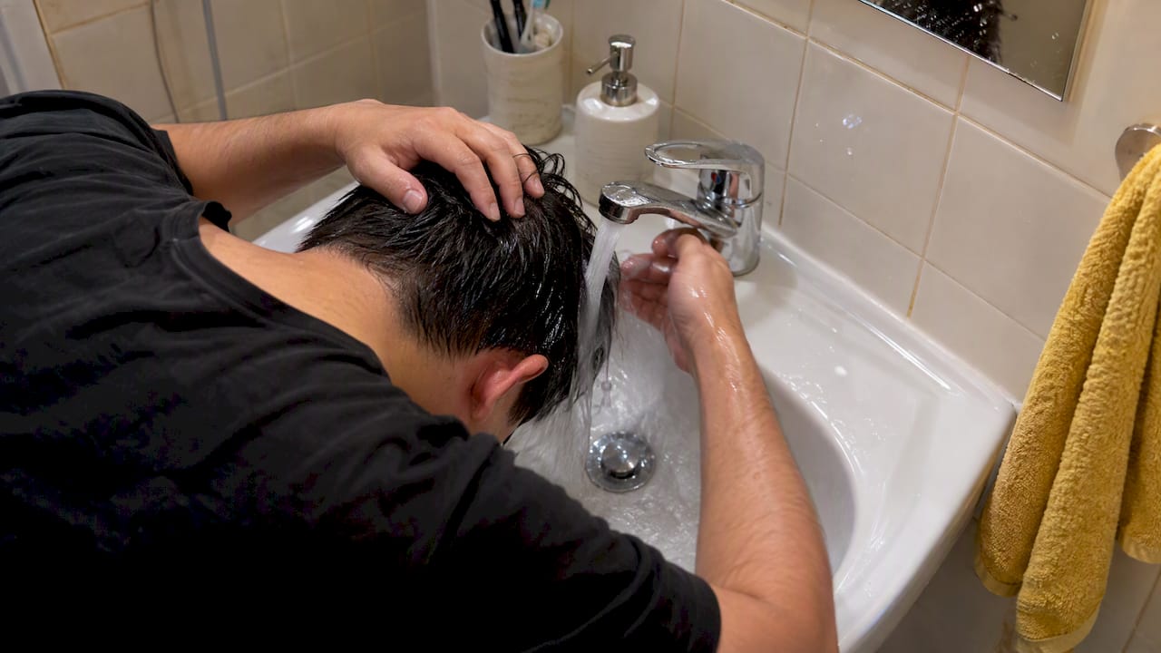 Person rinsing irritated scalp at bathroom sink