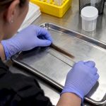 Technician measuring a scalp hair test sample