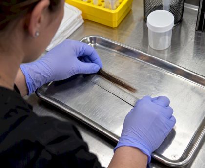 Technician measuring a scalp hair test sample