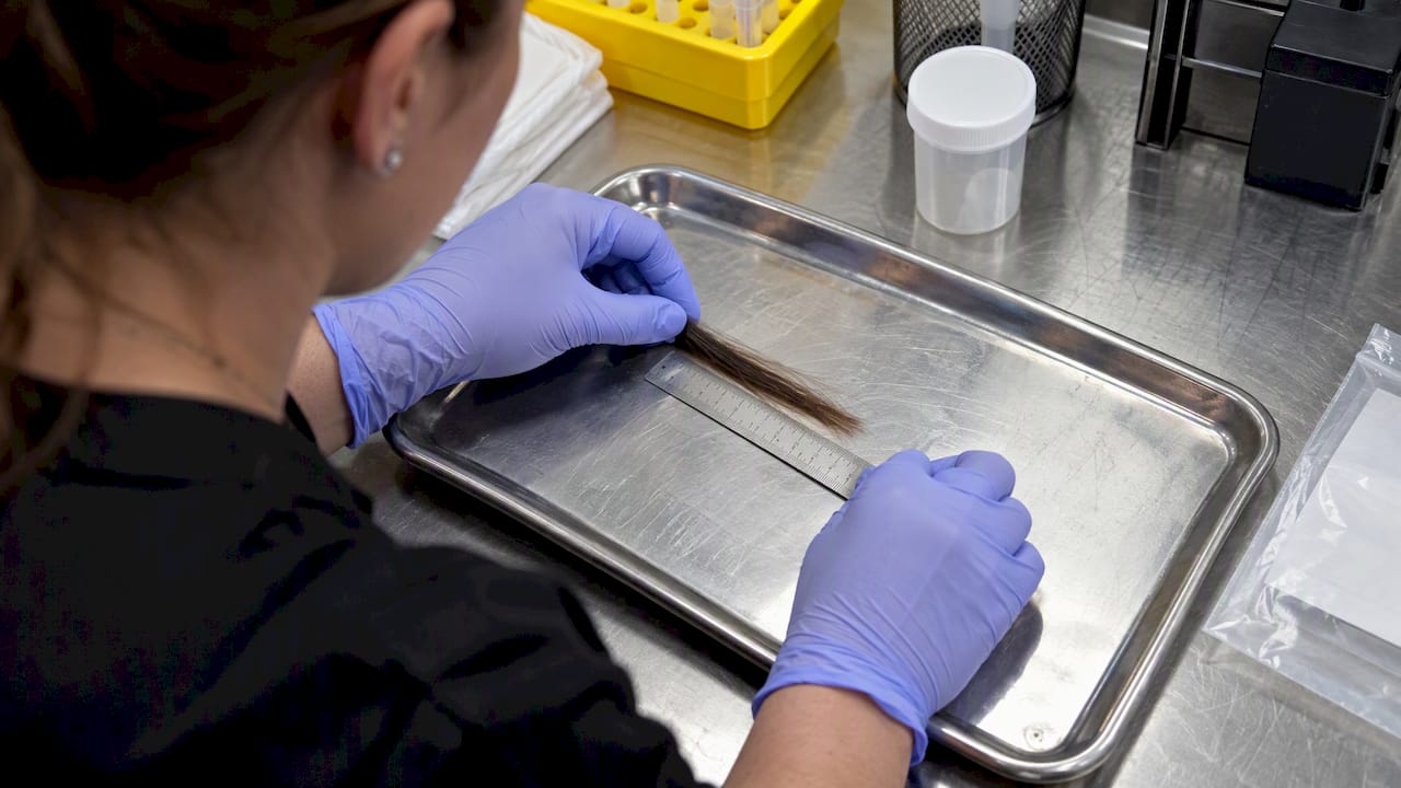 Technician measuring a scalp hair test sample