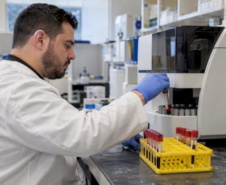Blood samples prepared for cannabinoid analysis